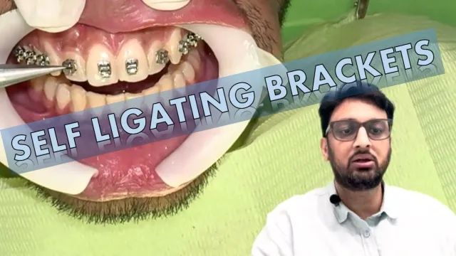 Orthomania online orthodontic course for general dentists